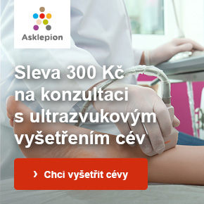 Asklepion - sleva 300 Kč na konzultaci na cévy s ultrazvukovým vyšetřením